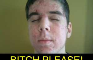 Estudio Revela que Adolescentes con Espinillas tienen el miembro mas grande que quienes no las tienen